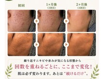 エビアス(Ebias)