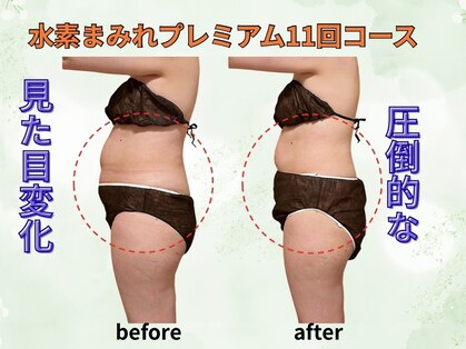 ヨサパーク フラネ(YOSA PARK Flaner)の写真