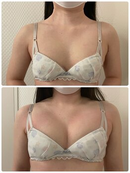 プレフィール(PLEAFEEL)/