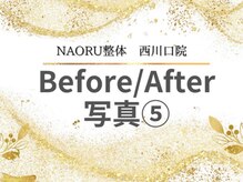 ナオル整体 西川口院(NAORU整体)/西川口 蕨 戸田 整体 骨盤矯正