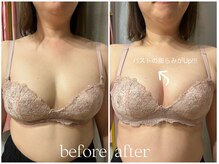 ビウラ(BIURA)/【40代】5回コース