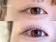 ユーアイ(Yu_eye)の写真