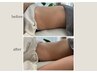 【だる重い体ケアと本気の体型革命】何しても痩せにくい人に◎ゆるかっさ