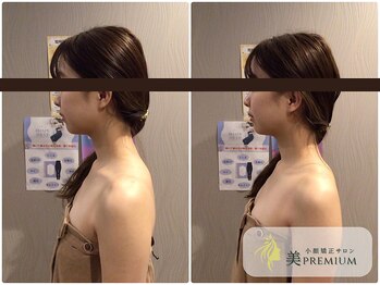 美プレミアム 川越店/360°美顔小顔矯正｜施術結果