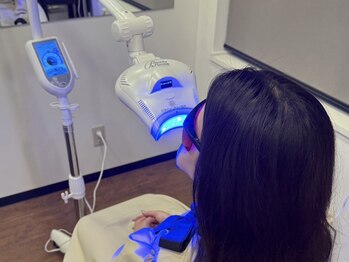 ヴィヴァーチェ(VIVACE)の写真/小顔×ホワイトニング＊印象がガラリと変わる白い歯で笑顔に自信を♪透明感のある自然な白さを☆