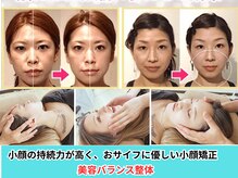 持続しない小顔矯正にお金をかけてはいけません。持続＝ゆがみ