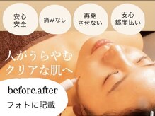 サロン ドロップ 上小田井(Salon drop)