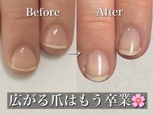 リリー/広がって伸びる爪が変化