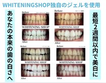 ホワイトニングショップ 豊橋店(WHITENING SHOP)