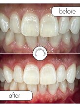 ホワイトマジック(White Magic)/before→after