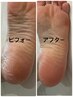 FOOT　乾燥が気になる今こそ！足裏ちゅるちゅる角質ケア￥9000→¥7000