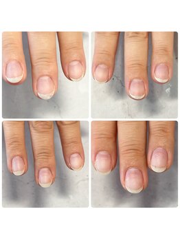 ルアマナ(Luamana)/自爪育成・クリア