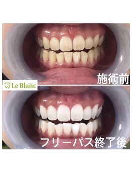 ルブラン 奈良店(Le Blanc)/歯の役割知ってますか?