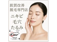 エーオーバー(A over')