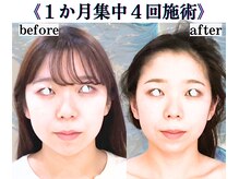 ボナボナ 仙台立町(BONA BONA)/右目の下がりと顔の大きさが嫌！