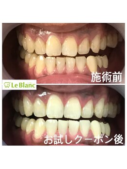ルブラン 奈良店(Le Blanc)/お試しで効果実感！！