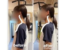 カワル整体 上通り院/ストレッチについて