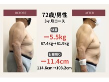 ピアリーノ(Pialino)/