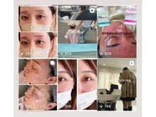 ルブニール(Lubenir.)の雰囲気（デザインやbefore after@lubenirインスタ毎日更新中♪ ）