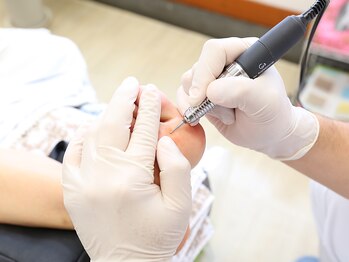 足のケア アンド 巻き爪 エムズ 白金通り店(M's)/魚の目ケア