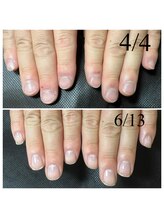 アマランサス(Amaranthus)/深爪で見せれない爪を見せる爪に