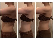 ナチュール(NaTuRu)/ブライダルボディ3回/20代