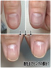 スマイルニコ(smile nico)/指先まで爪