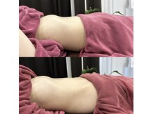 【腸活！便秘改善】腸もみ！最強デトックス