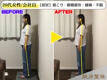 幸せのもり整体院/【20代女性／会社員】Sさん