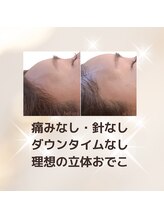 ワイズ 沖縄うるま院(Medical Y's)/ヒアルより自分の脂肪を育てる