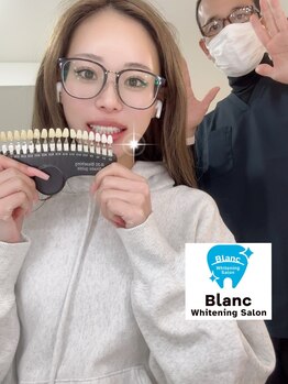 ブラン 心斎橋店(Blanc)/ホワイトニング施術例