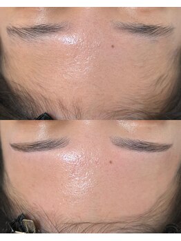 ビビ(BIBI)/大人気おでこWAXと眉毛のセット