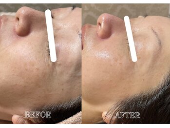 リス ブラン(Lys Blanc)/リゼネレートフェイシャル