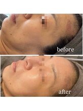 ラルミエール 緑店はなれ(la lumiere)/リゼネレート