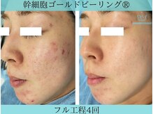 リメイク 広尾(REMAKE)/