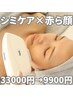 【人気NO.３】赤ら顔☆業界初話題のシミケア ×お悩み別光フォト33000→9900