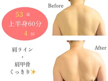 アルピナ(ALPINA)/ウルトランスフォーマー