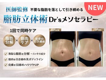 イーズスリミングプロ 横浜コレットマーレ店の写真/【脂肪立体術】脂肪分解×筋肉ケア×皮膚の引き締めが同時に叶う!痩せるだけではない脂肪分解新技術☆