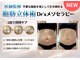 イーズスリミングプロ 横浜コレットマーレ店の写真/【脂肪立体術】脂肪分解×筋肉ケア×皮膚の引き締めが同時に叶う!痩せるだけではない脂肪分解新技術☆