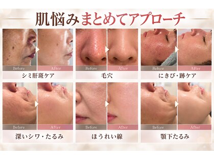 ミライ(Mirai)の写真