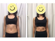 くまがい整体院 若松店/骨盤矯正＋EMS＋食事指導