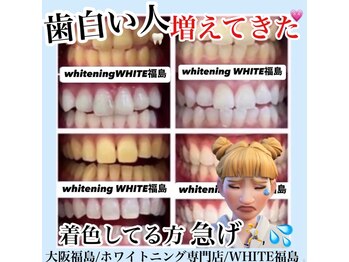 ホワイトニングサロン ホワイト(WHITE)/セルフホワイトニング/大阪/福島