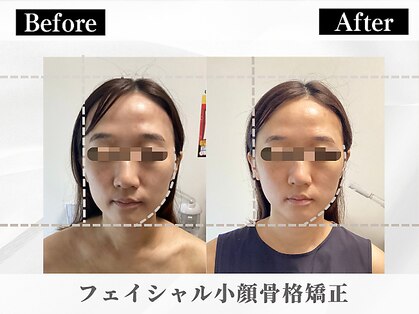 ポーベルポー(Peau Belle poe)の写真