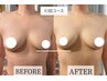 【花嫁様♪美胸プログラム】上半身引き締め×上向バストGET 《10回コース》