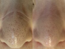 サイセイ(SAISEI)/