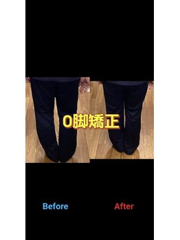 伏見一心整体院/O脚矯正