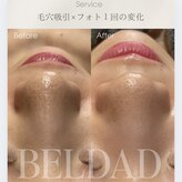 ベルダ(BELDAD)