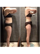 フローボディ 新山口店(flow BODY)/山口のエステはflow BODY