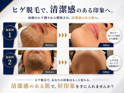 ベイス(BASE)の写真