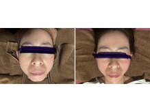 イールーム(eroom)の雰囲気(効果実感の声多数の小顔UPフェイシャル!たるみ・しわ悩みに◎)
